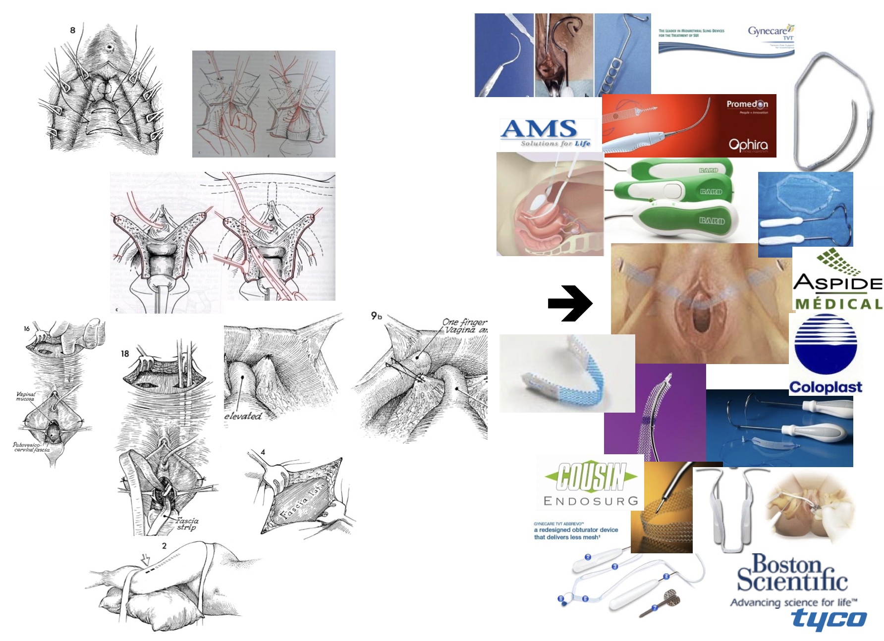Phương pháp Marshall-Marchetti-Krantz