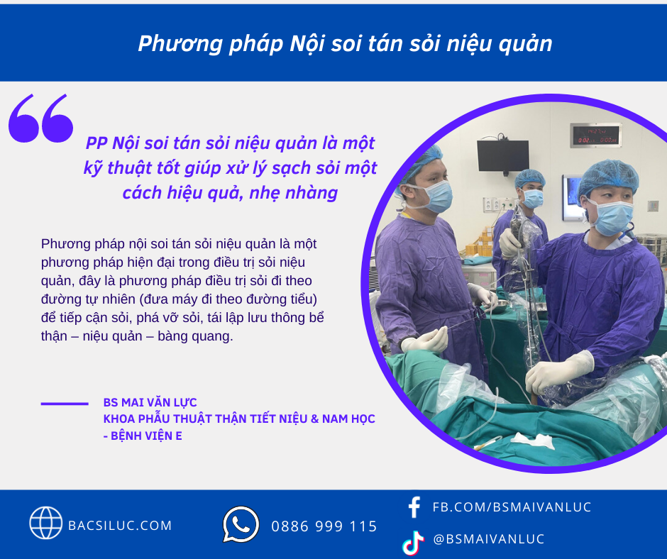 Phương pháp nội soi tán sỏi ngược dòng