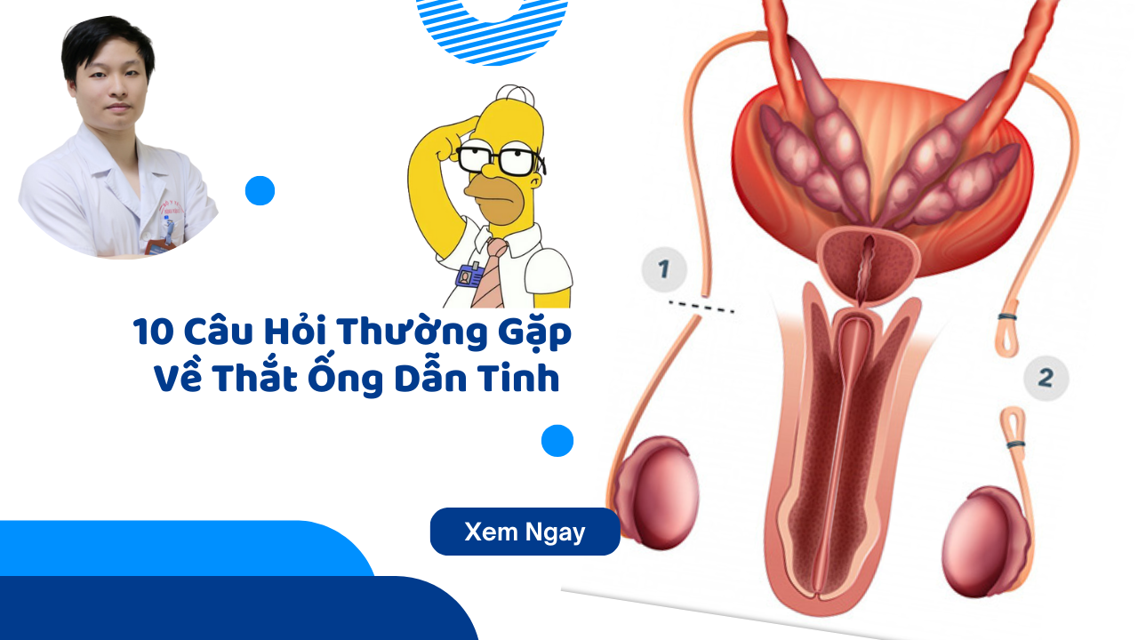 10 câu hỏi thường gặp về thắt ống dẫn tinh