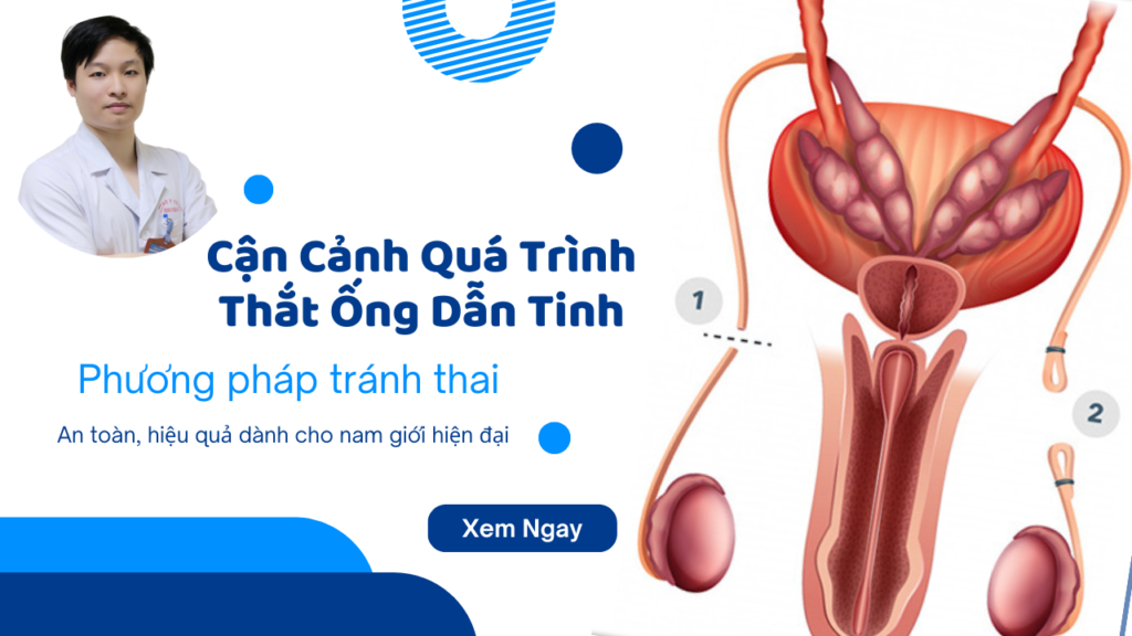 Video cận cảnh thắt ống dẫn tinh