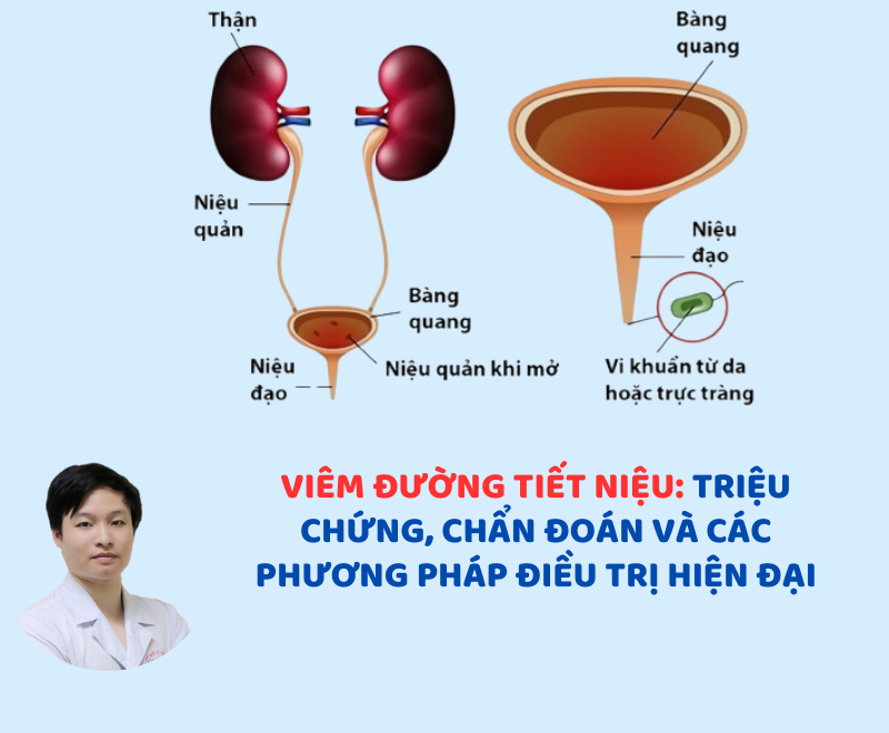 Viêm đường tiết niệu: Triệu chứng, chẩn đoán và các phương pháp điều trị hiện đại