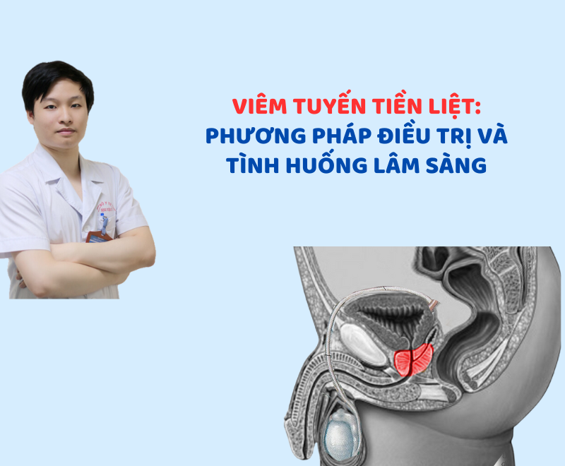 Viêm tuyến tiền liệt: Phương pháp điều trị và tình huống lâm sàng