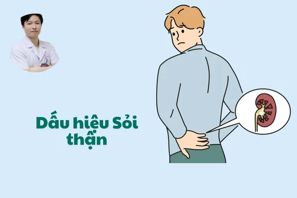 8 Dấu hiệu Sỏi thận Cảnh báo Bạn cần đi khám ngay