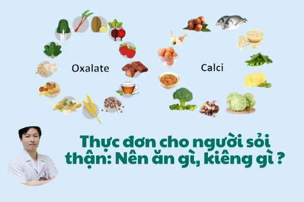 Thực đơn cho người sỏi thận: Nên ăn gì, kiêng gì để bệnh không trở nặng?