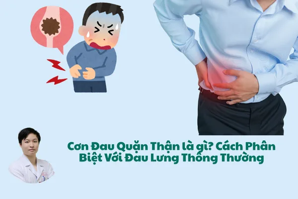 Cơn Đau Quặn Thận là gì? Cách Phân Biệt Với Đau Lưng Thông Thường